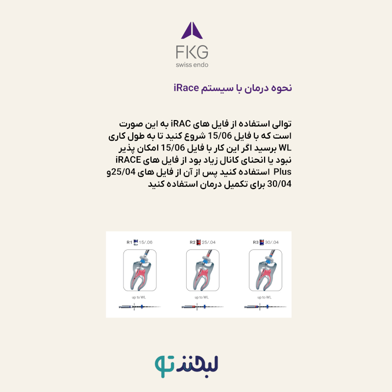 فایل روتاری FKG – iRace 31mm - تصویر 7