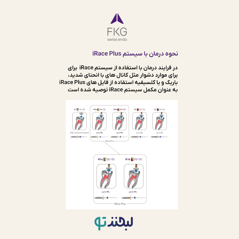 فایل روتاری FKG – iRace 31mm - تصویر 8